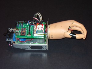Prosthetic Hand Prototype Prosthetic Hand Prototype